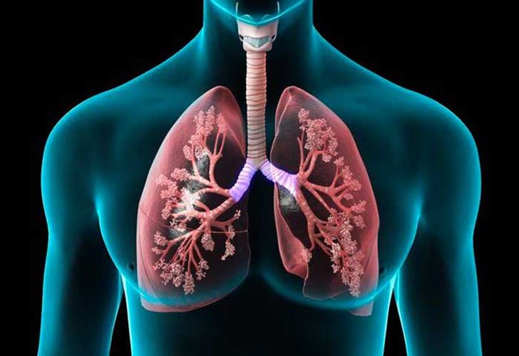 tuberculosis activa, infección bacteriana, pulmones, estudio,