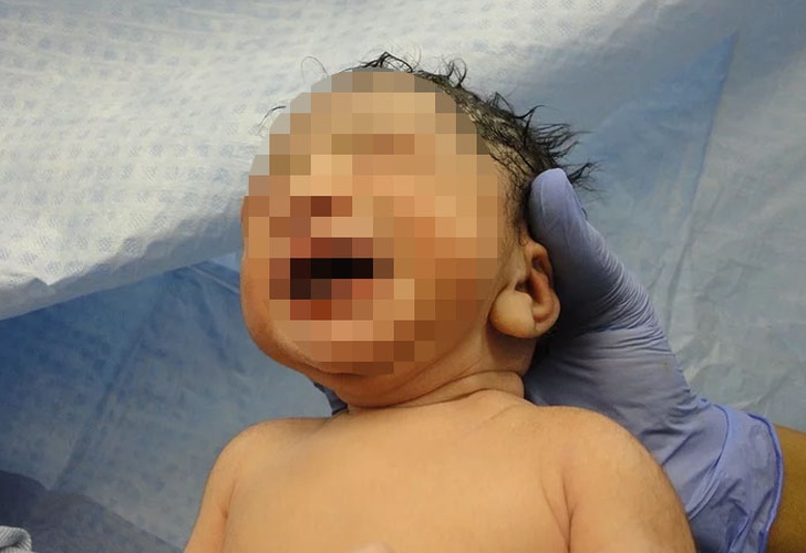 Resultado de imagen para Mujer embarazada con COVID-19 dio a luz a bebé sano en Honduras