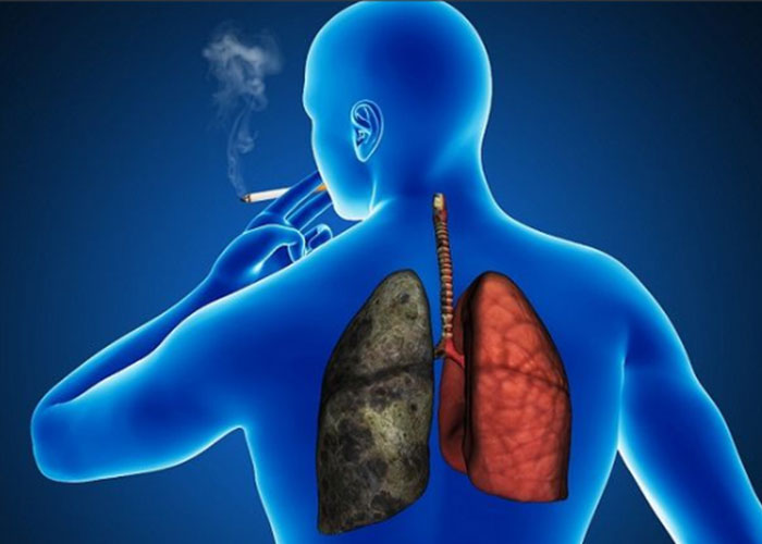 contaminación y tabaquismo factores de riesgo que más dañan los