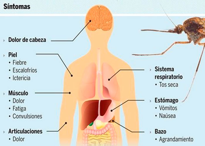 sintomas, oms, malaria, picaduras, afectados, mosquiteros, mosquitos, prevencion
