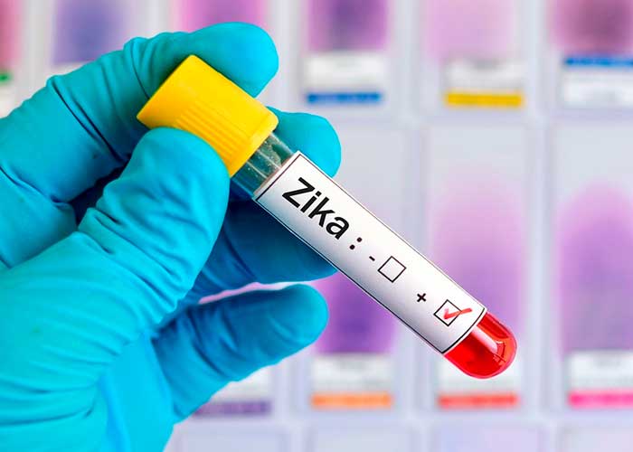 zika, brasil, salud, tipos, consecuencias, identificacion, monitoreo genetico, nueva epidemia
