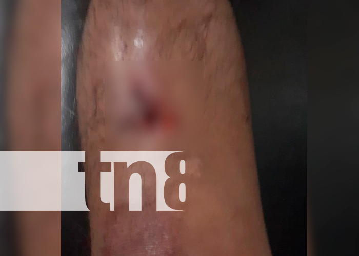 Foto: Choque entre motocicletas deja un lesionado en la Isla de Ometepe/ TN8 