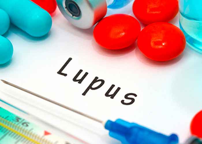 salud, lupus, dia mundial, sintomas, causas