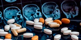 salud, alzheimer, farmaco, aprobacion, estados unidos