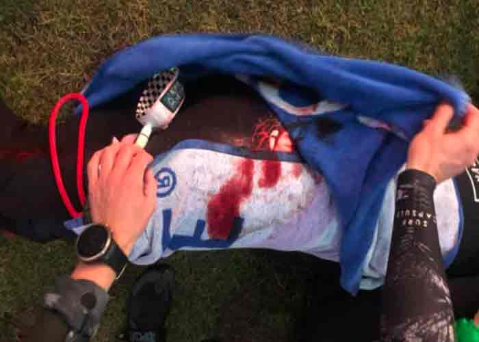 Revelan sangrientas fotos del ataque de un tiburón a un surfista sudafricano