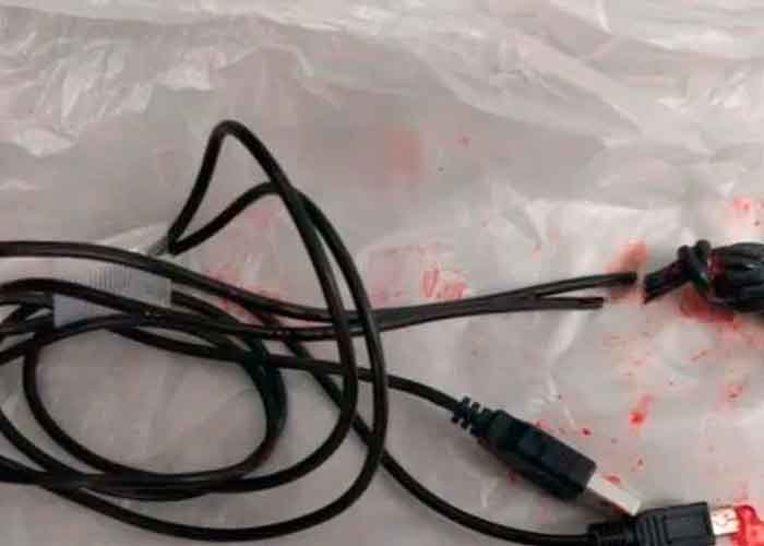 El adolescente, de 15 años, se atascó el cable USB dentro del pene después de “intentar medir cuánto tiempo tenía”.