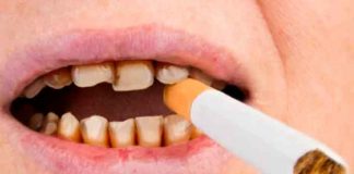 ¿Cómo afecta el cigarro a la salud de los dientes?