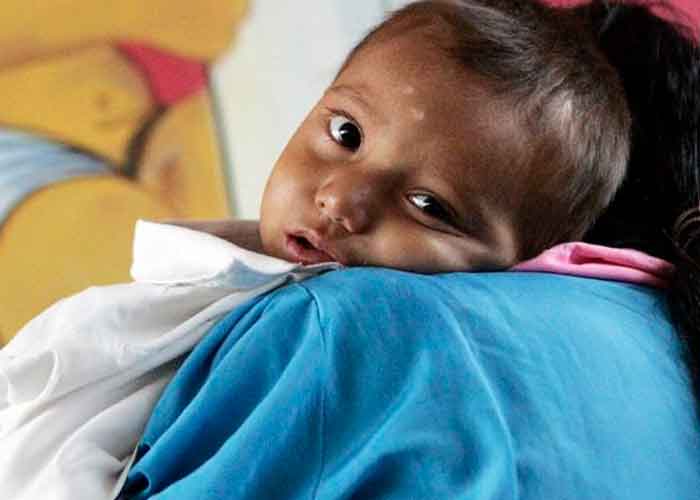 39 niños en Guatemala murieron de desnutrición aguda durante el 2021