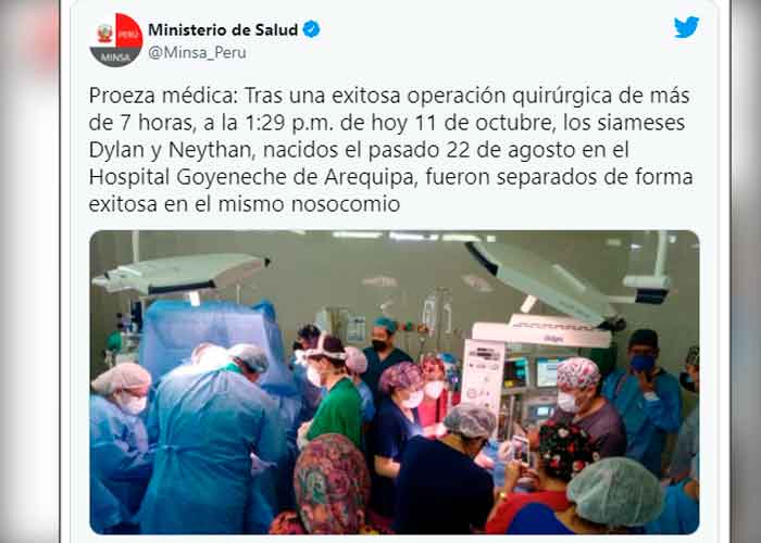 Tras 7 horas de cirugía en Perú separan a siameses unidos por la cadera