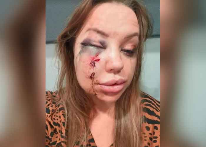 Mujer recibe una brutal golpiza tras conocer a un hombre por redes