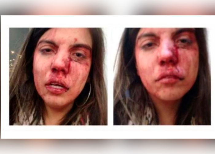 ¡Insólito! Mujer golpeada por su expareja es condenada a prisión en Colombia