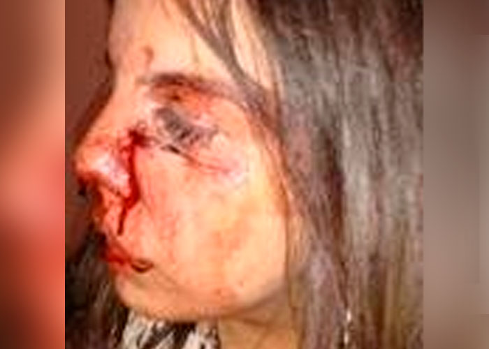 ¡Insólito! Mujer golpeada por su expareja es condenada a prisión en Colombia
