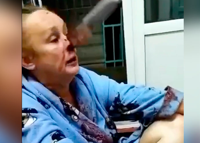 ¡Ataque brutal! Le clavaron un cuchillo en el rostro a una Mujer en Rusia