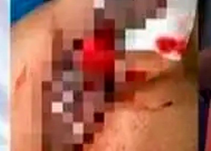 En Panamá  una mujer le arranca de un mordisco "la cola" un hombre 