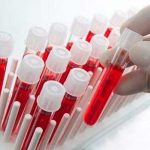 Crean el primer test de sangre capaz de detectar una variedad de cáncer