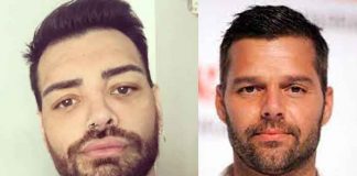 "Gemelo de Ricky Martin": Joven se hace cirugías para igualar al artista