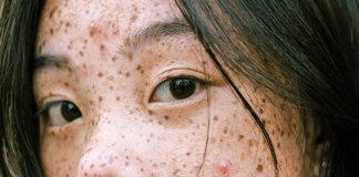 La ciencia demuestra que nadie nace con pecas