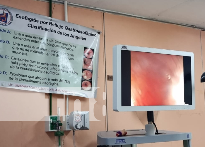 Más de 40 pacientes atendidos en jornada de endoscopia en Managua