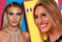 El antes y después de sus cirugías de Lele Pons ahora esposa de Guaynaa