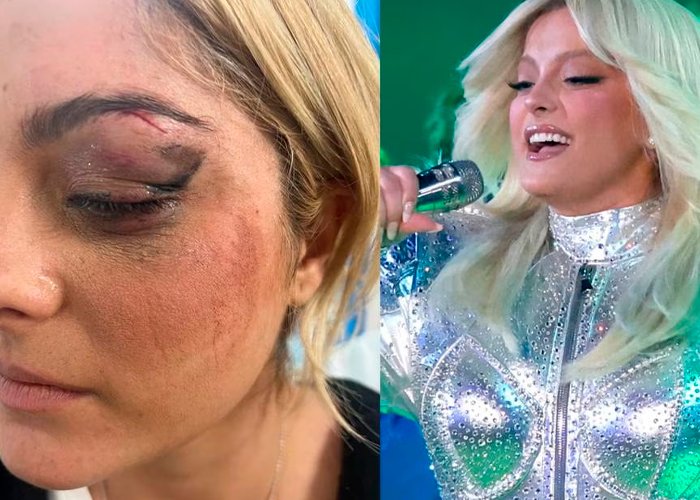 ¡Clase guasmazo! Fan le tira celular a la cara a Bebe Rexha y la manda al Hospital