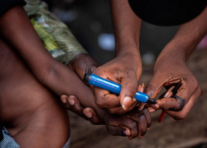 Foto: 19 niños fallecen por complicaciones de sarampión en el noreste de Nigeria / Cortesía