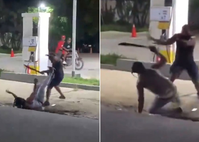 Hombre pierde la mano durante pelea en República Dominicana