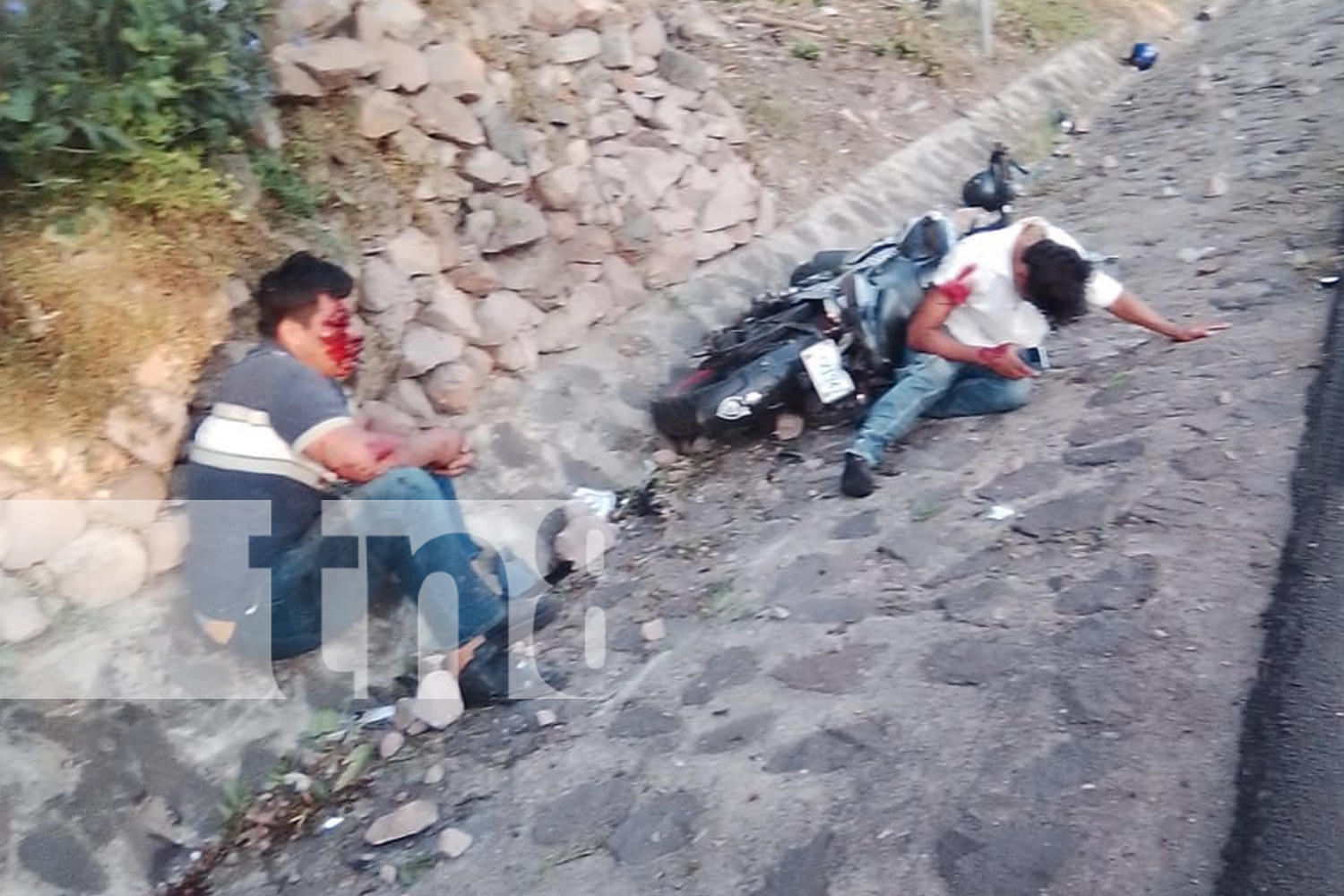 Foto: Accidente vial en Juigalpa: Dos jóvenes hospitalizados tras estrellarse con un muro/TN8