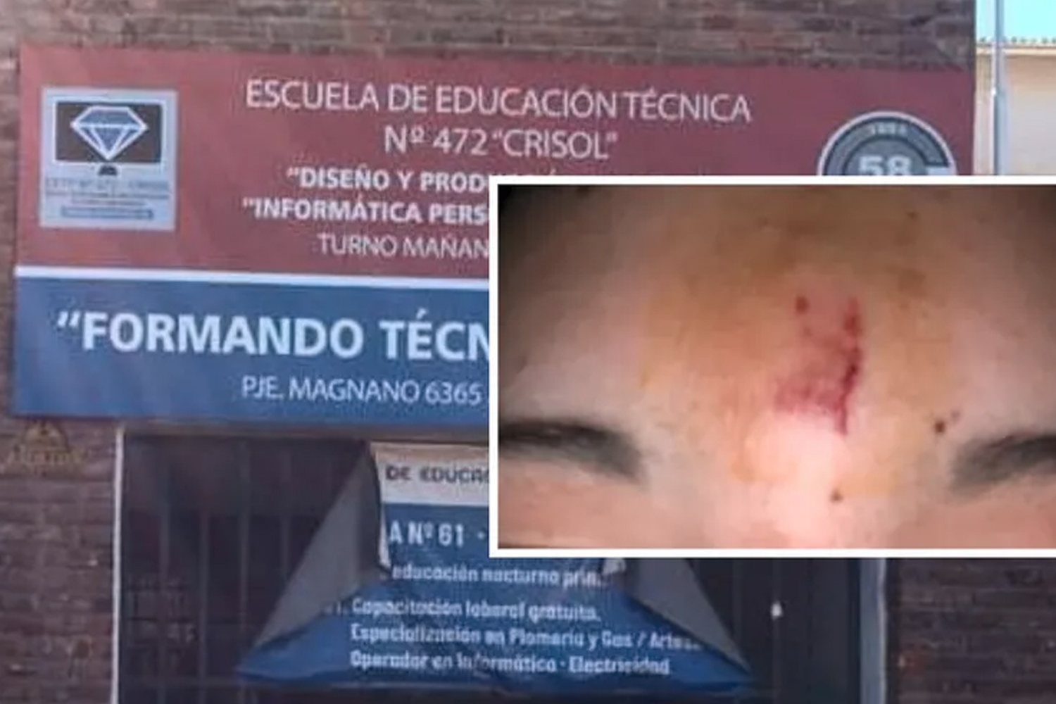 Foto: Le tiró un borrador en la cabeza, a un estudiante en Argentina/ Cortesía