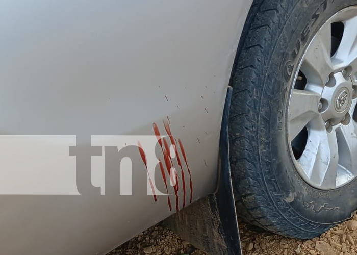 Foto: Padre e hijo se salen de la vía e impactan de frente contra un árbol en Rivas / TN8