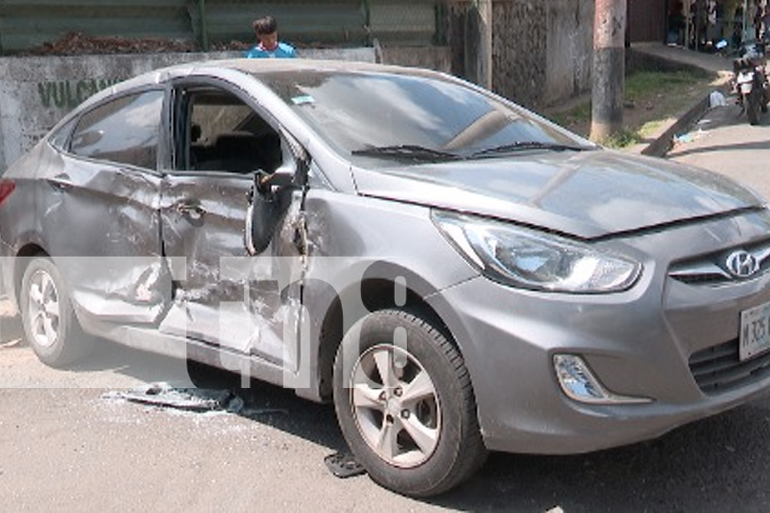 Choque entre carro y camión deja a una mujer herida en el barrio 19 de julio en Managua