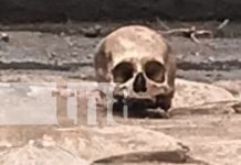 Foto: Encuentran cráneo humano en plena vía pública en San Marcos, Carazo/TN8