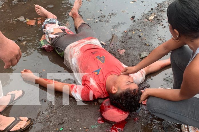 Foto; Hombre machetea a su cuñado en Chinandega / TN8