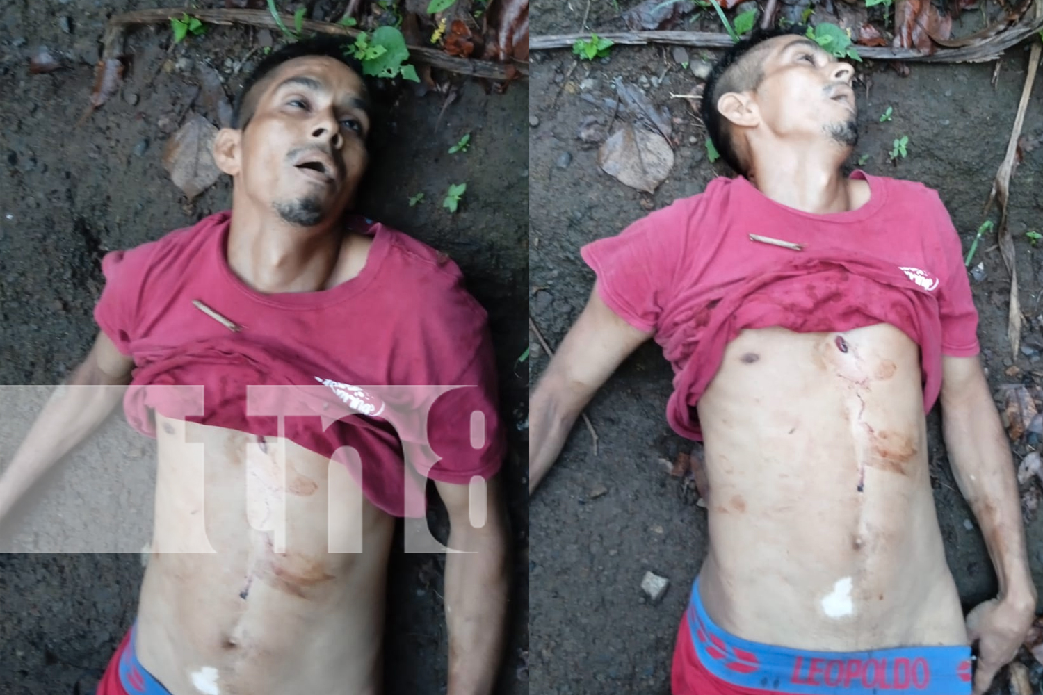 Foto:Hallazgo macabro: Ciudadano es encontrado muerto en Pochocuape/TN8