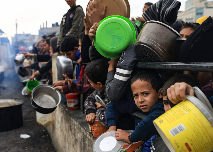 Foto: Niños están en peligro de morir en Gaza por desnutrición /Cortesía