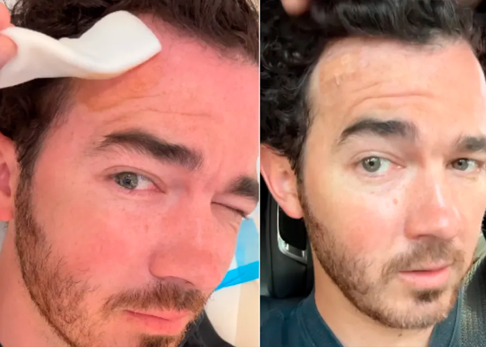 Foto: Kevin Jonas habla sobre su salud /cortesía 