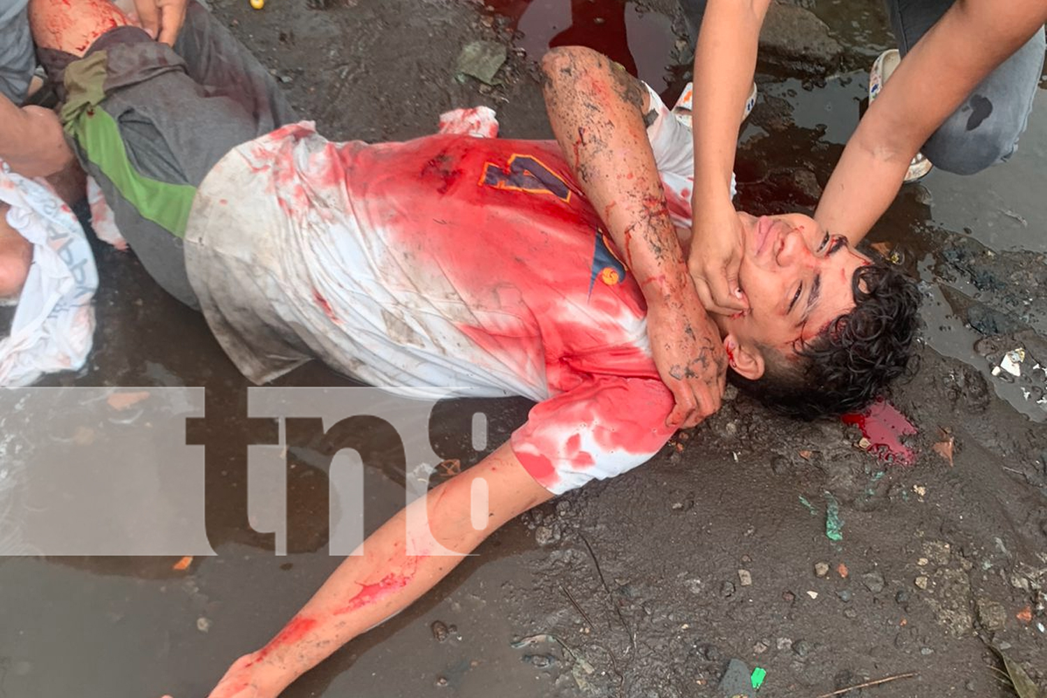 Foto; Hombre machetea a su cuñado en Chinandega / TN8