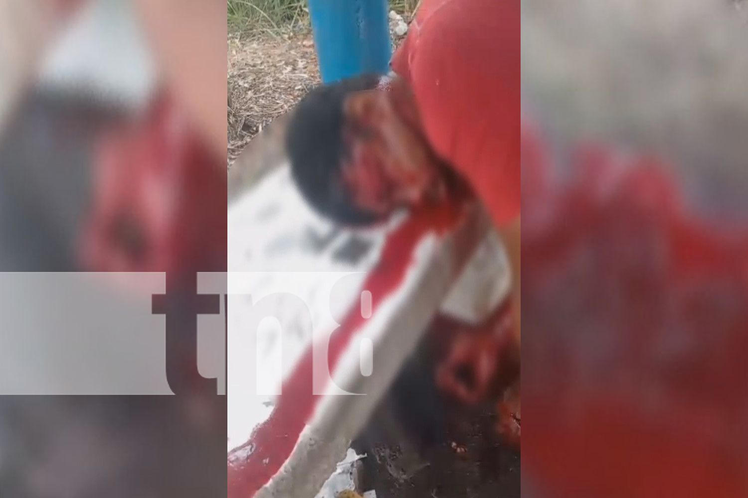 Foto: Brutal ataque con machete en Rivas deja a hombre gravemente herido/TN8