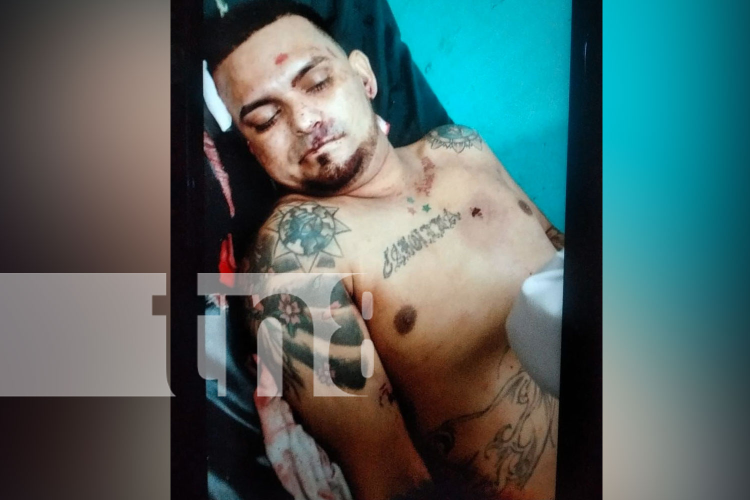 Foto: Un hombre es asesinado de varios impactos de bala el municipio de Sébaco Matagalpa/TN8