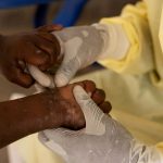 Foto: África declara emergencia sanitaria por brotes de mpox en 13 países