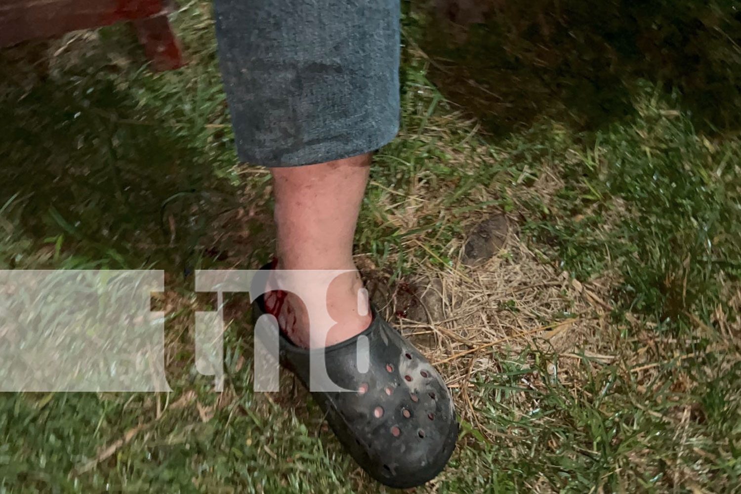 Foto: En Chontales un fuerte accidente entre dos motos deja a una persona lesionada/TN8