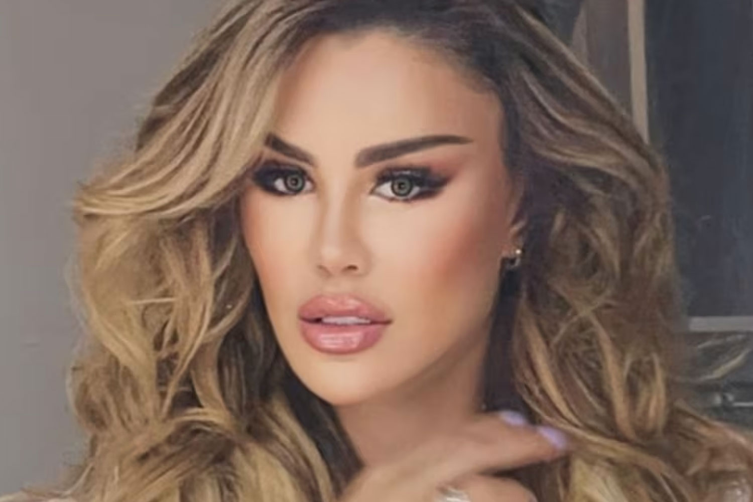 Foto: Ninel Conde responde a las críticas tras presumir nuevo rostro /Cortesía