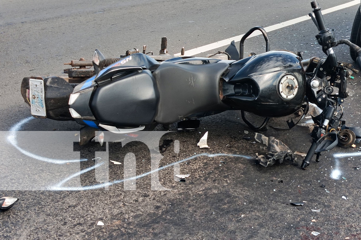 Foto: Joven de 19 años herido gravemente en accidente de motocicleta en Masaya/TN8