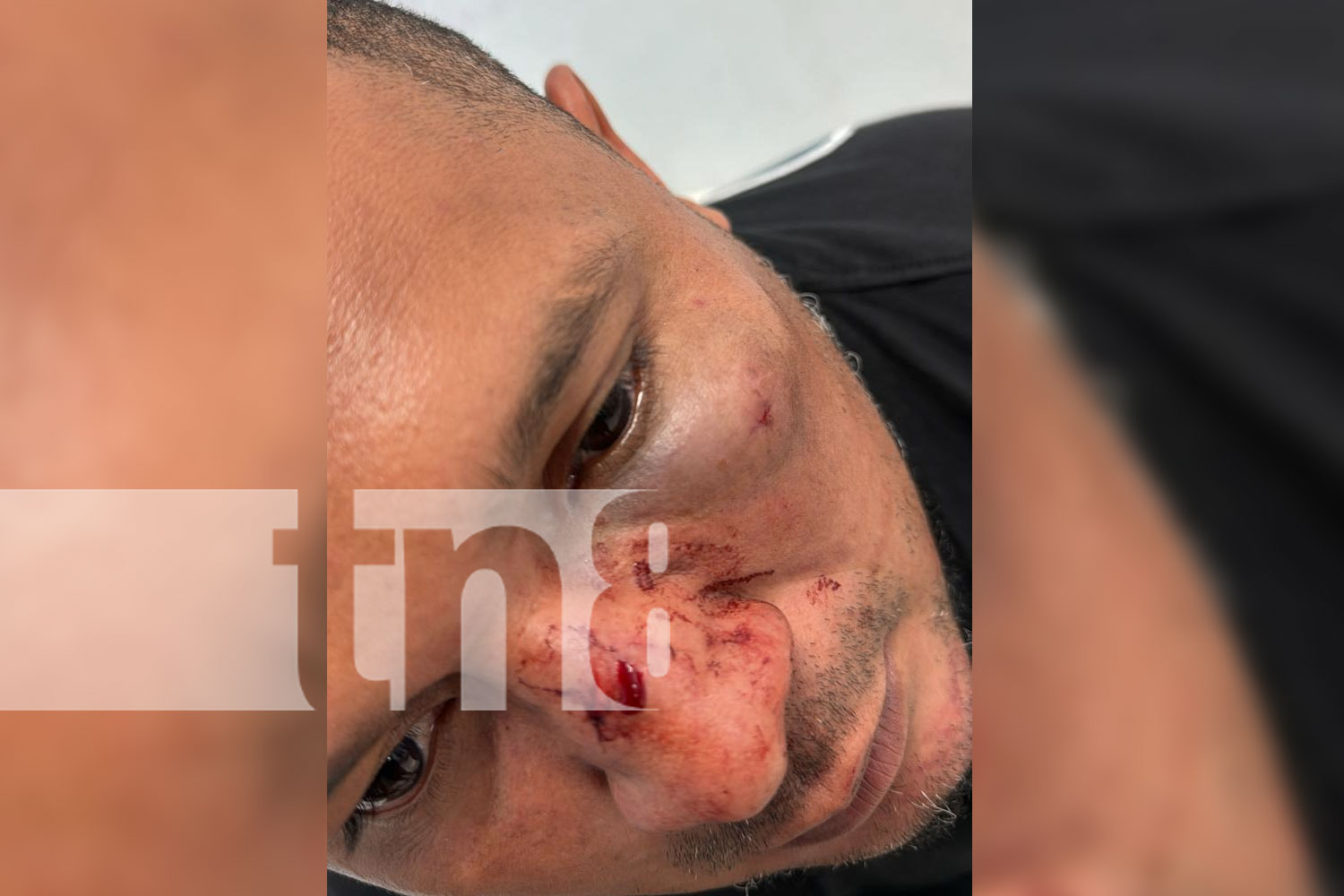 Foto: Escándalo en Rivas: "Loco Brayan" detenido tras agresión en la vía pública/TN8