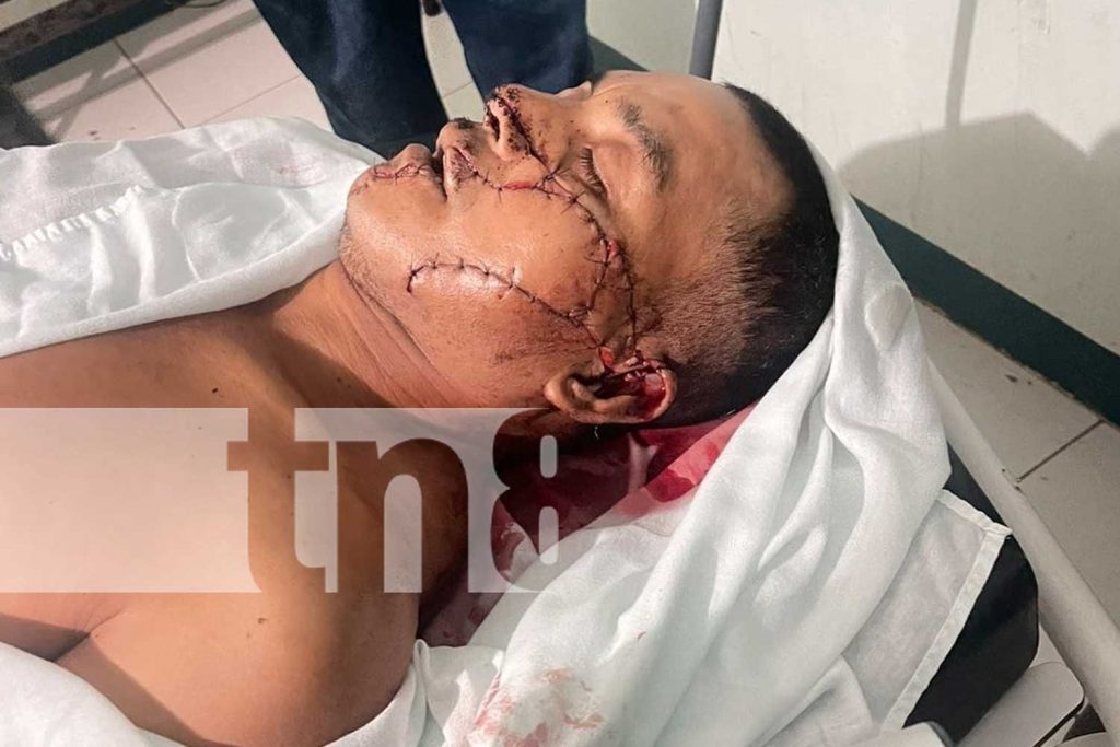 Foto: Doble crimen en Muelle de los Bueyes deja una víctima mortal y otro herido grave/TN8