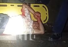 Foto: Un motorizado pierde una pierna tras brutal accidente en Jinotepe, Carazo / TN8