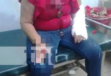 Foto: Agresión a una mujer en Chichigalpa, Chinandega / TN8