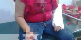 Foto: Agresión a una mujer en Chichigalpa, Chinandega / TN8