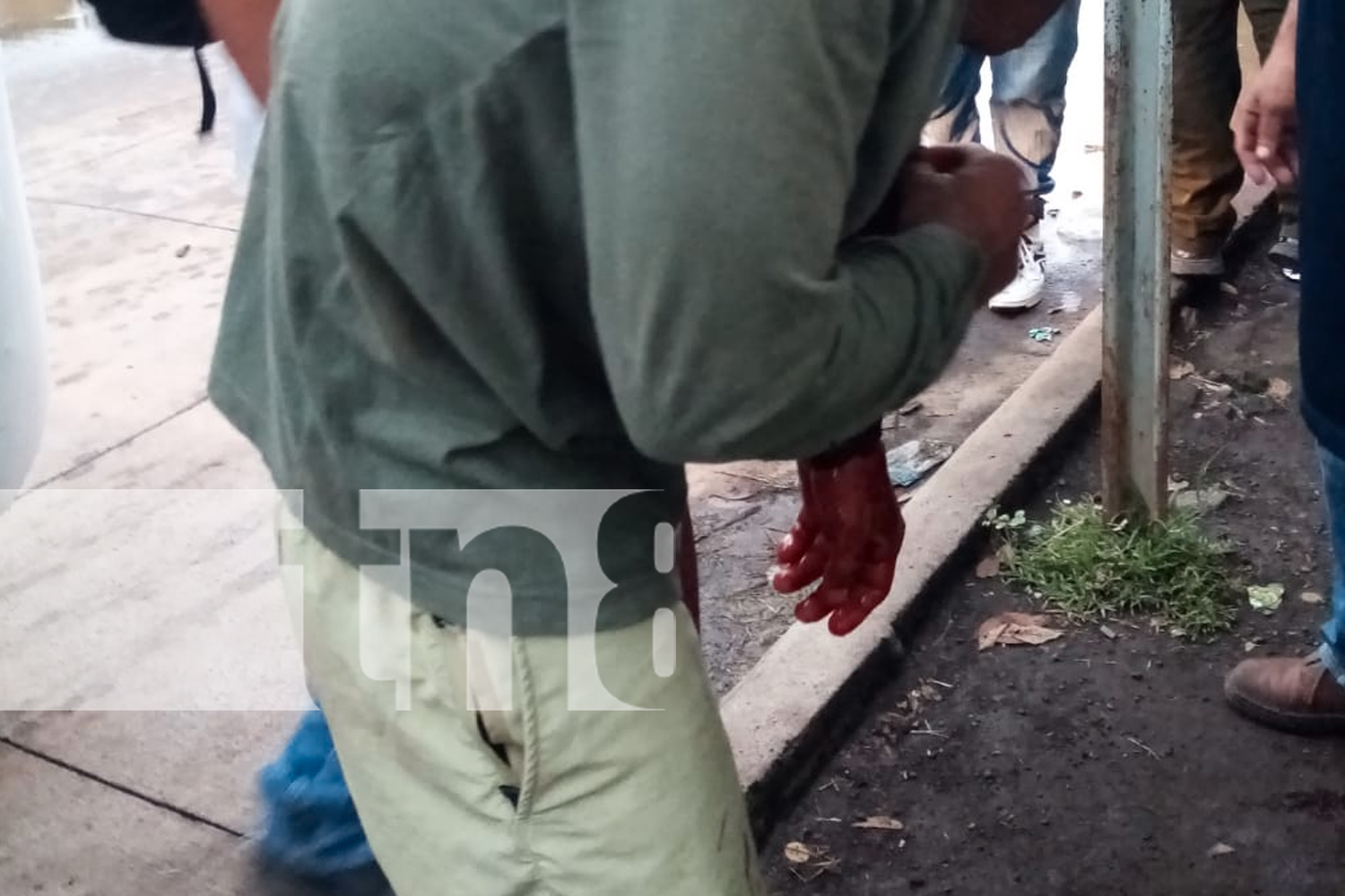 Foto: Joven de 25 años queda gravemente herido al quedar atrapado en la puerta de un autobús en Sábana Grande, Managua /TN8