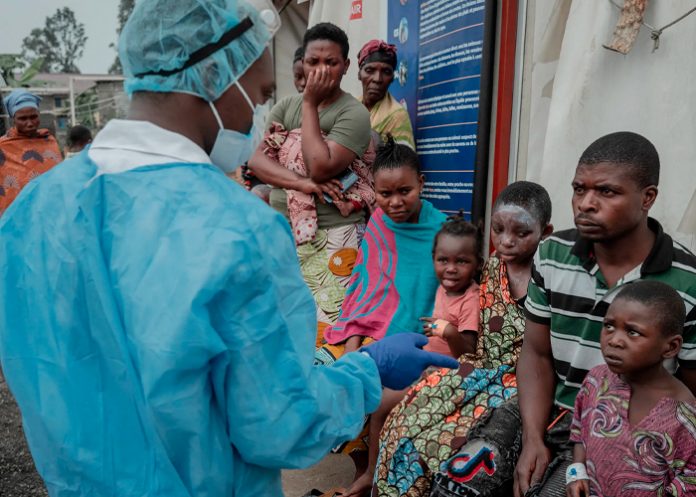 Foto: África ha registrado un total de 50,840 casos de mpox/Cortesía