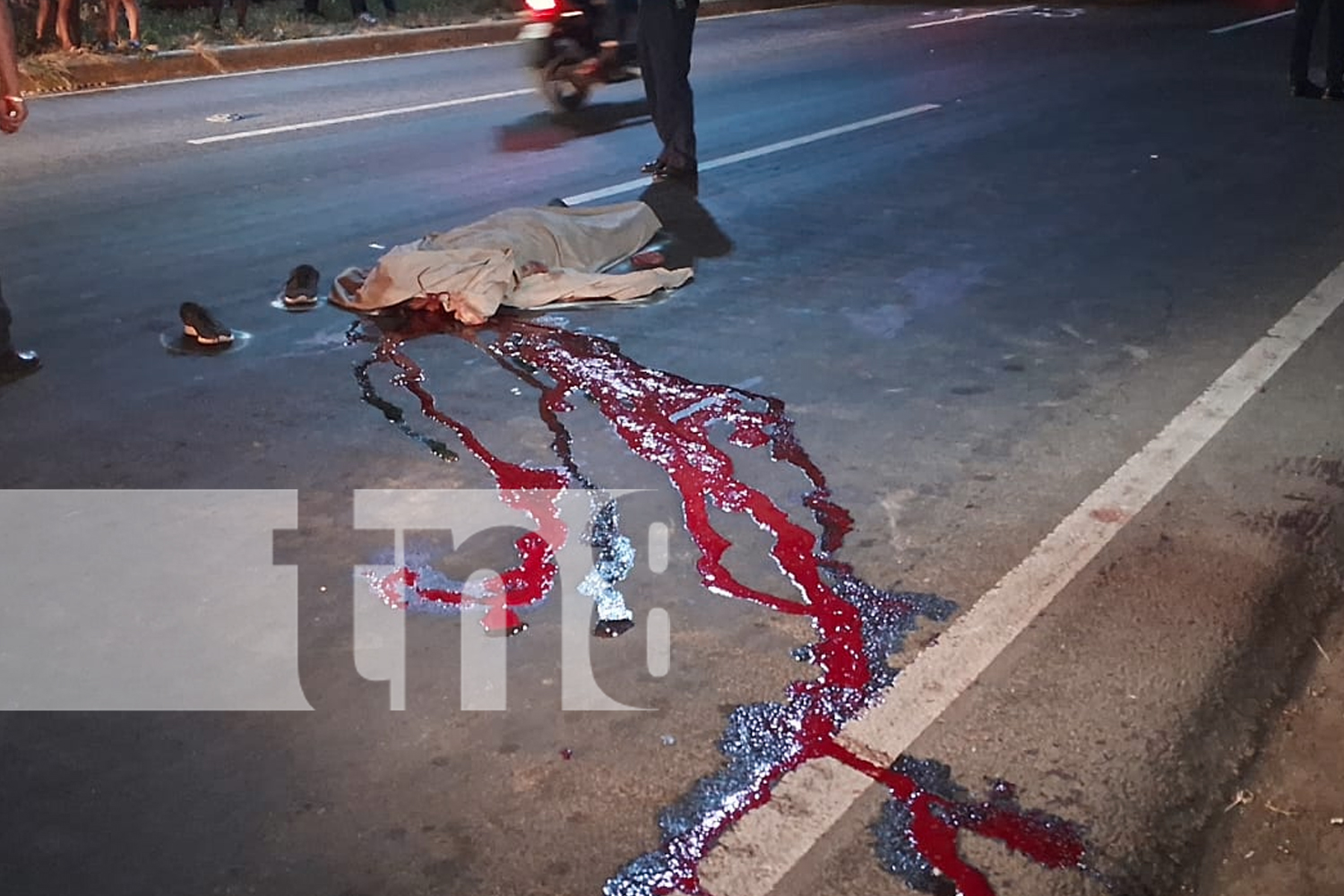 Foto: Un peatón pierde la vida tras ser arrollado por un motociclista en Carretera Norte/TN8